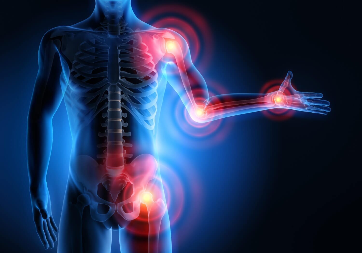 Die Vorteile von Yoga für Menschen mit Arthritis - yogabox